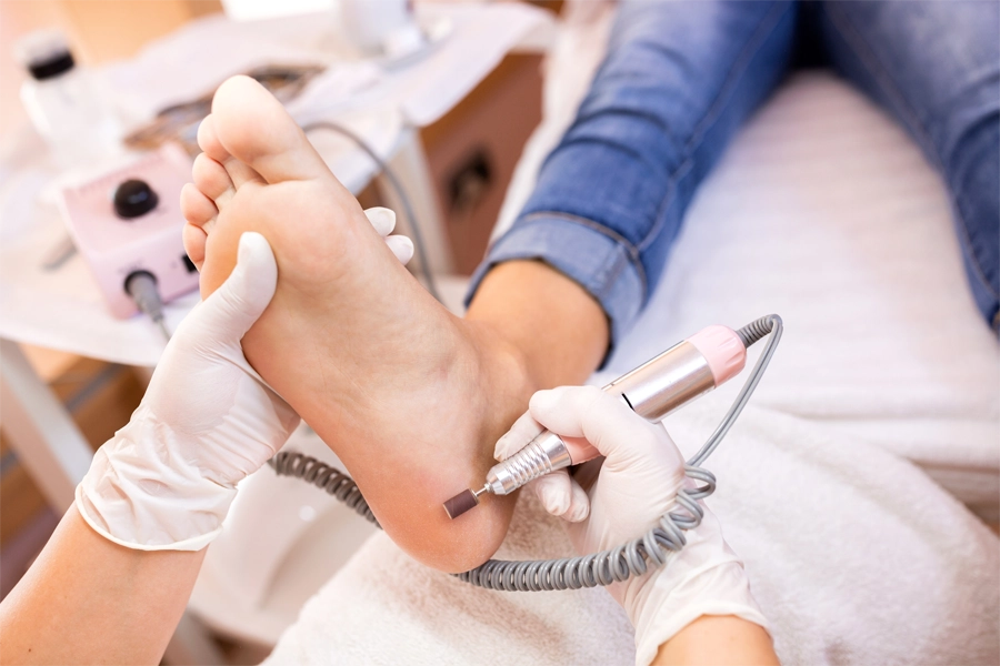 Podologia Extensão para Manicure e pedicure